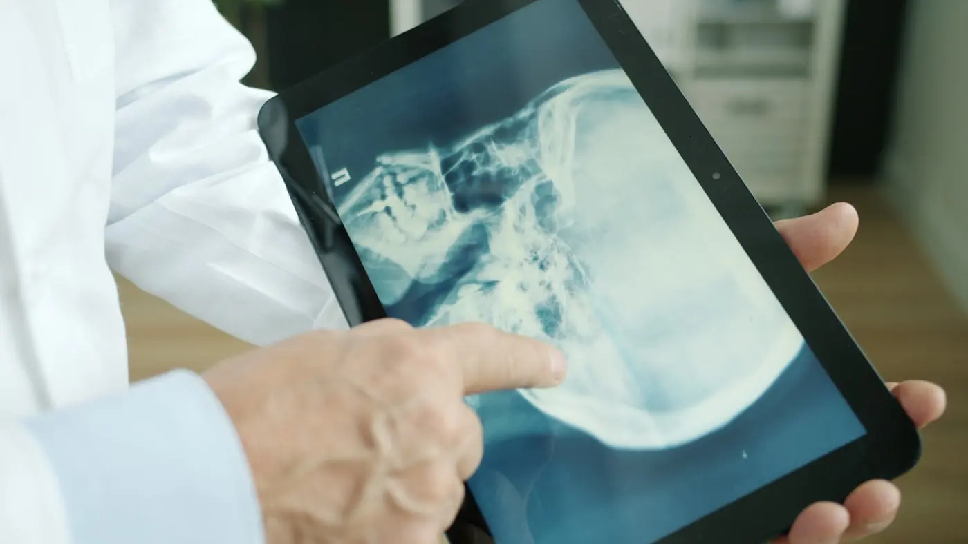 Ärztin zeigt ein Röntgenbild auf einem Tablet